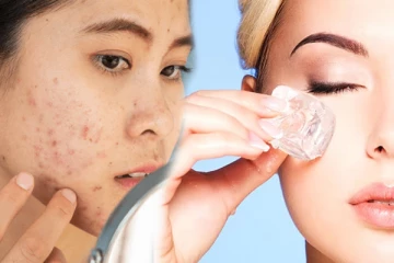 முகப்பருவால் பொலிவிழக்கும் சருமம்! இதுதான் சிறந்த வழி