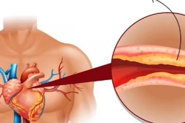 உங்கள் உடலில் உள்ள கொலஸ்ட்ரால் அளவை குறைக்க வேண்டுமா?