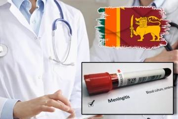இலங்கையில் மெனிஞ்சைடிஸ் வைரஸ் தொற்றுடன் 237 பேர் அடையாளம்