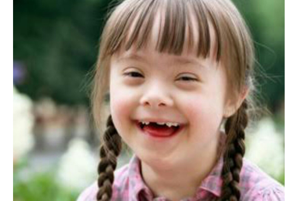 ஏன் மன வளர்ச்சி குன்றிய குழந்தைகள் பிறக்கின்றன? ஆய்வுக்கு உட்படுத்திய 5000 பேரில் 2000 பேருக்கு பாதிப்பு - தமிழ்நாடு