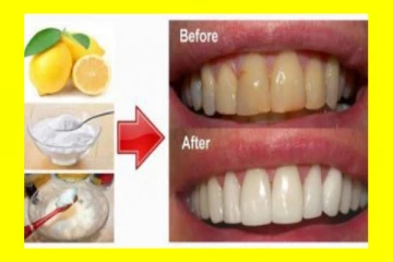 மஞ்சள் நிற பற்கள் வெள்ளை ஆகணுமா? அப்போ இதை செய்திடுங்கள்