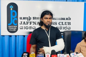 யாழ் இளைஞனை சித்திரவதை செய்து கையை உடைத்த பொலிஸார்