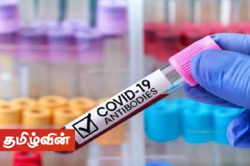 கொரோனா தடுப்பூசி ஏற்றிக்கொண்ட ஹோட்டல் ஊழியர் மரணம்