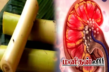 கிட்னியை சுற்றி பாதுகாப்பு வளையம் போடும் வாழைத்தண்டு- யாரெல்லாம் சுவைக்கலாம்?
