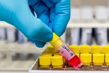 யாழில் மேலும் 18 பேருக்கு கோவிட் ! நல்லூரை சேர்ந்த வயோதிபப் பெண் சாவு