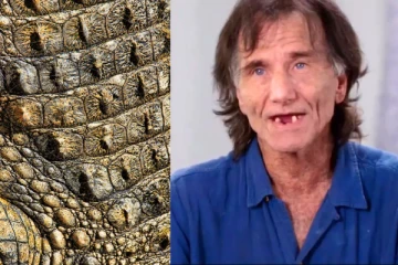 ஒவ்வொரு நாளும் நரக வேதனை - முதலை போன்ற தோலுடன் போராடும் மனிதன்