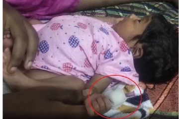 அலட்சியத்தால் துண்டான பச்சிளம் குழந்தையின் விரல்!  பேரதிர்ச்சி கொடுத்த  செவிலியர்