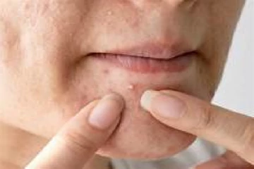 කුරුලෑ ඇති ෙවන්න බලපාන ඔබ නොහිතන පුරුදු මෙන්න..