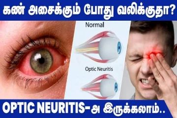 கண் அசைவில் அதிகமாக வலி உண்டாகிறதா? இந்த பிரச்சினையாகவும் இருக்கலாம்!