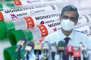 குரங்கம்மை தொற்று நோய் குறித்து வைத்திய நிபுணர் அறிவிப்பு