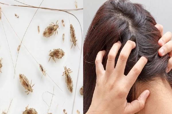 நம்ம தலையில் எப்படி பேன் வருதுன்னு தெரியுமா? வியக்க வைக்கும் உண்மைகள்! | Do You Know How Lice Get On Our Heads