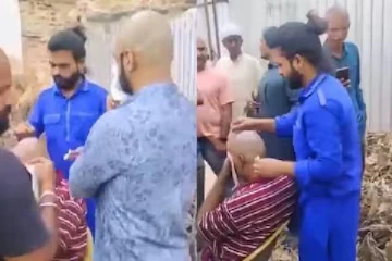 வழுக்கை தலையில் முடி வளரும் - லோஷன் வாங்கிய 500 ஆண்களுக்கு நேர்ந்த கதி