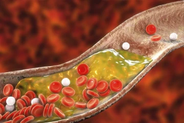உடலில் கெட்ட கொழுப்புக்கள் சேர்வதை தடுக்க வேண்டுமா? கவலைய விடுங்க