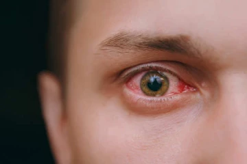 தமிழகத்தை அச்சுறுத்தும் கொடிய நோய்! இந்த அறிகுறிகள் இருந்தால் எச்சரிக்கையாக இருங்க