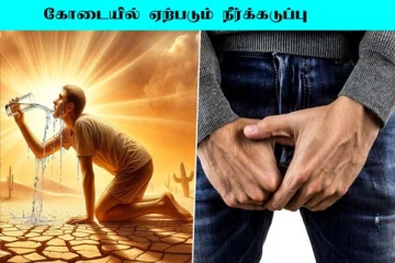 நீர்க்கடுப்பு பிரச்சினையால் அவதியா? உடனடி நிவாரணம் பெறலாம்