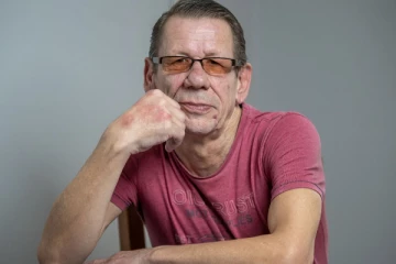 பற்களை சரிசெய்வதற்காக உக்ரைனுக்கு பறந்த பிரித்தானியர்: வெளியான உண்மை காரணம்