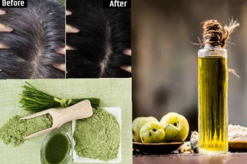 உங்களுக்கு இளநரை பிரச்சினையா... தீர்வு இதோ!