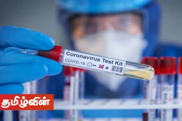 மற்றுமொரு நாடாளுமன்ற உறுப்பினருக்கும் கொரோனா தொற்று உறுதி