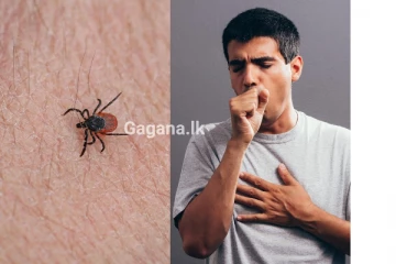 වහාම හැමෝම දැනුවත්වන්න..!කිණිතුල්ලන්ගෙන් මිනිස්සුන්ට බෝවෙන බිහිසුණු වෛරසය..