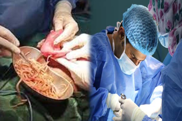 வயிறுவலியால் துடித்த சிறுவன்! ஒரு கிலோ புழுவை எடுத்து அதிர்ச்சி கொடுத்த மருத்துவர்கள் | Boy Stomach Pain 1Kg Worm Shocking