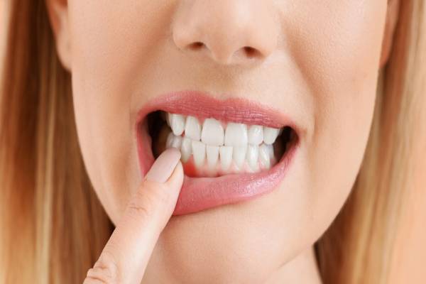 ஈறு அழற்சி பிரச்சினை முடிவுக்கட்டும் பூண்டு சாறு ஈறு அழற்சி பிரச்சினை முடிவுக்கட்டும் பூண்டு சாறு