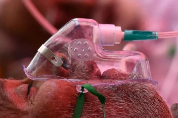 காலி கராப்பிட்டி மருத்துவமனையில் உயிரிழந்தவர் கரும்பூஞ்சையால் பாதிக்கப்படவில்லை-  மருத்துவர்