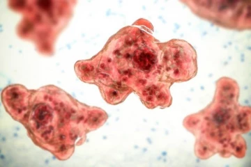 அமெரிக்காவில் குழாய் நீரை பயன்படுத்திய நபர் அதிர்ச்சி மரணம்! தெரிய வந்த உண்மை