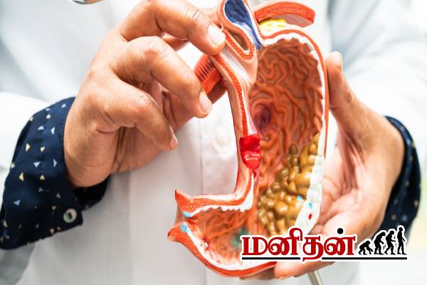 ரோபோ சங்கர் உயிரை காவு வாங்கிய நோய்