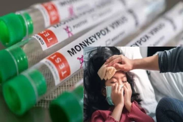 குரங்கு காய்ச்சல் புதிய கோவிட் - 19 திரிபு அல்ல! உலக சுகாதார அமைப்பு வெளியிட்ட தகவல்