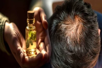 இந்த பொருள் சேர்த்து எண்ணெய் செய்து போடுங்க- வழுக்கையிலும் முடி முளைக்கும்!