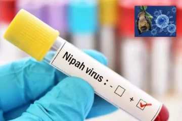 6 ஆண்டுகளுக்கு பிறகு தலைதூக்கிய வைரஸ்! 14 வயது சிறுவன் உயிரிழப்பு