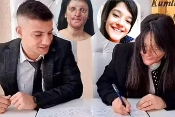 ஆசிட் வீசிய   காதலனை  திருமணம் செய்த இளம்பெண்!