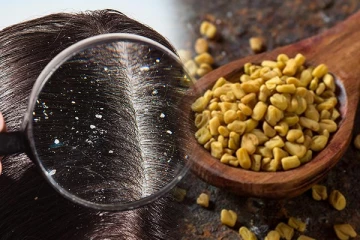 பொடுகை விரட்ட இந்த ஒரு பொருள் மட்டுமே போதும்!  இப்படி பயன்படுத்தி பாருஙக