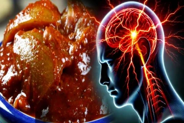 ஒற்றை தலைவலி இருக்கா? அப்போ 'இந்த' உணவுளை தவறியும் சாப்பிடாதீங்க!