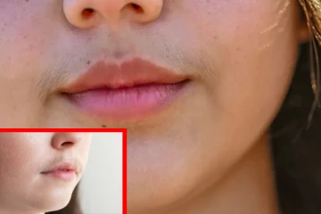 வயதிற்கு ஏற்ப முகத்தில் முடி அதிகமாகிறதா? - நிபுணர்களின் கருத்து இது தான்!