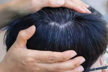இளம் வயதில் நரை முடி பிரச்சனையா? இதுவே அதற்கு முக்கிய காரணங்கள்