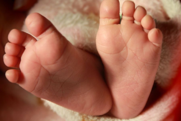 இரண்டு பிறப்புறுப்புகளுடன் பிறந்த ஆண் குழந்தை! | Baby Boy Born With Two Genitals Pakistan இரண்டு பிறப்புறுப்புகளுடன் பிறந்த ஆண் குழந்தை! | Baby Boy Born With Two Genitals Pakistan
