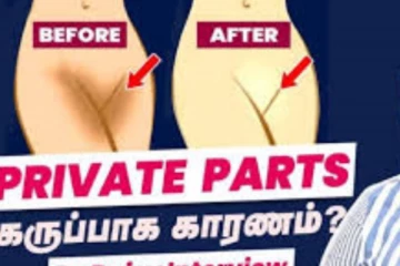 அந்த இடம் கருப்பாக இருக்க காரணம் என்ன தெரியுமா? உடல் சார்ந்த பிரச்சினைகளுக்கு காணொளி விளக்கதுடன்...