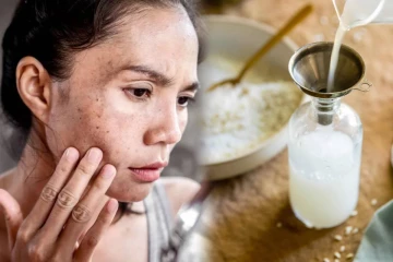 முகத்தின் கரும்புள்ளிகளை நீக்க உதவும் அரிசி நீர்.., எப்படி பயன்படுத்துவது?