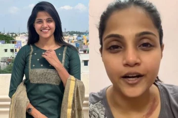 காரில் சென்றபோது விபத்தில் சிக்கிய முத்தழகு சீரியல் நடிகை வைஷாலி- காயங்களுடன் அவரே வெளியிட்ட வீடியோ