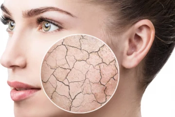 பெண்களே சருமம் வறண்டு பொலிவிழந்து காணப்படுகிறதா? இதனை எப்படி போக்கலாம்?