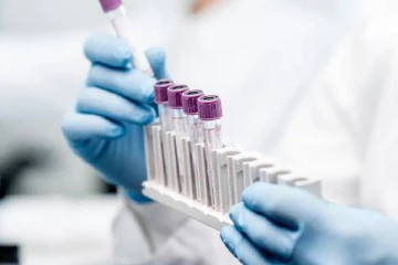 புதிய திரிபு குறித்து இலங்கை எச்சரிக்கையாக உள்ளது!