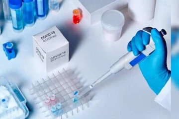 அவுஸ்திரேலியா செல்லும் இலங்கையர்களுக்கு கட்டாயமாக்கப்பட்டுள்ள ஆன்டிஜன் பரிசோதனை