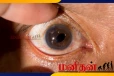 Cataracts symptoms: கண் பார்வைக்கு சேதம் விளைவிக்கும் நோய்- அறிகுறிகளுடன் ஆபத்துகள்..