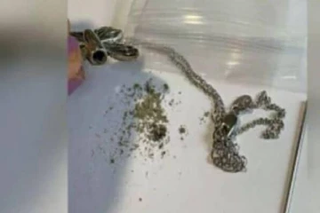 அமேசானில் நெக்லஸ் ஆர்டர் செய்த கனேடியப் பெண்ணுக்கு காத்திருந்து பேரதிர்ச்சி!