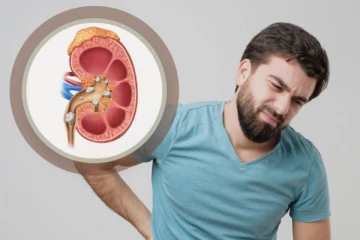 சிறுநீரக கல் பிரச்சனை இருக்கா உங்களுக்கு? கண்டிப்பாக தவிர்க்க வேண்டிய உணவுகள்