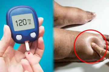 உலகை அச்சுறுத்தும் சர்க்கரை நோய்யை எளிதில் தடுக்கலாம்!