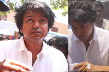 நடிகர் விஜய்யின் கையில் ஏற்பட்ட பலத்த காயம்.. வெளிவந்த புகைப்படத்தால் ரசிகர்கள் அதிர்ச்சி