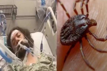 உண்ணி கடித்ததால் வினை; கை, கால்களை இழந்த நபர் - கவனமா இருங்க.!