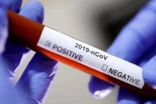 கிளிநொச்சி பொறியியல் பீட மாணவனுக்கு கொரோனா தொற்று உறுதி